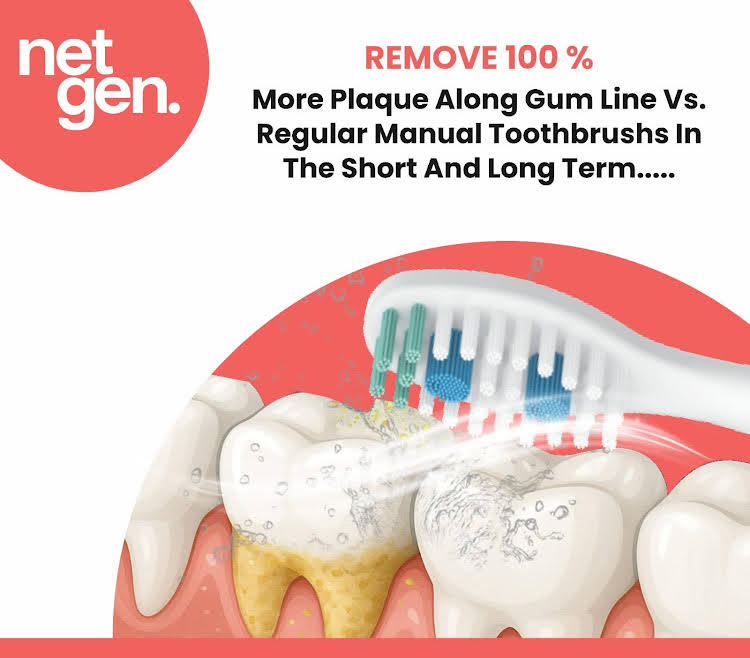 Replacement Sonic Toothbrush Heads - Classic White